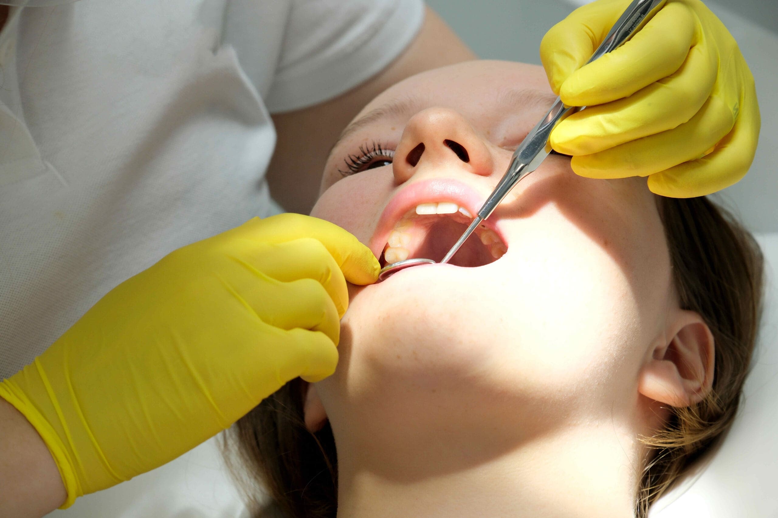 Tooth Extraction Tools: What Dentists Use for the Procedure